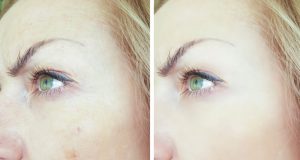 Facelift : La tendance maquillage pour paraître plus jeune ! Facelift